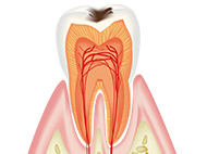 C1