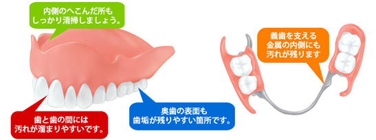 義歯の清掃