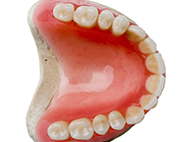 熱可塑性義歯（アクリJ）